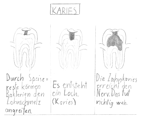 KARIES